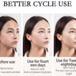 baizton-anti-freckle-kit_1.jpg