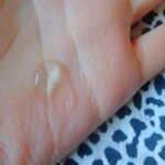 beauty-formulas-tea-tree-blemish-gel_1.jpg